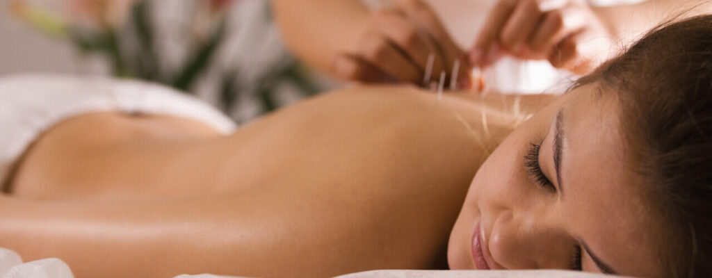 Discovering the Ways that Acupuncture Can Benefit You!