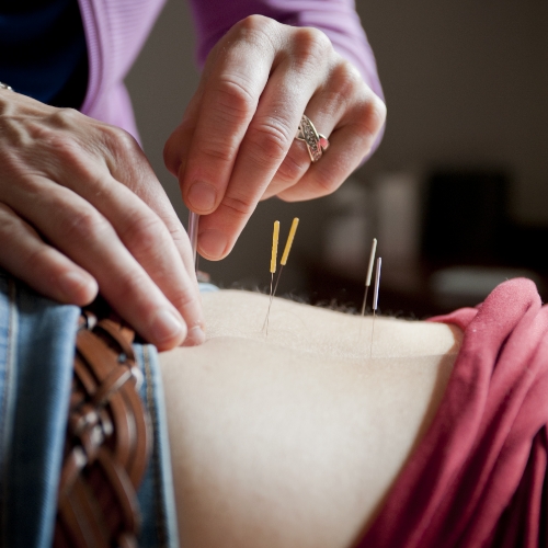 acupuncture-therapy-Vineyard-complementary-medicine-marthas-vineyard-edgartown-ma