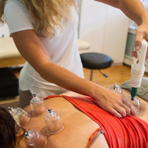 cupping-therapy-Vineyard-complementary-medicine-marthas-vineyard-edgartown-ma
